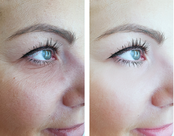 Bildvergleich einer Augenpartie