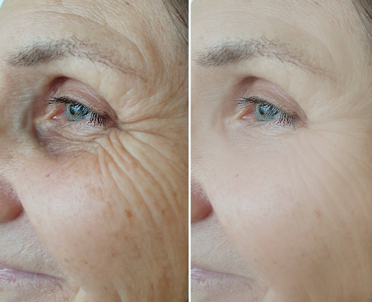 Bildausschnittvergleich Augenpartie